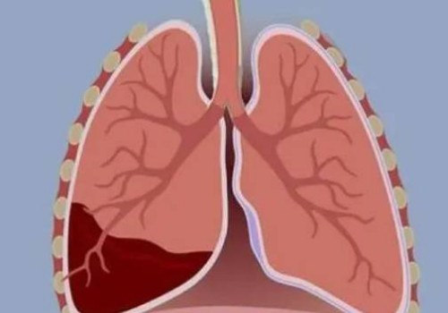 深圳助孕机构：绝经后激素六项标准多少_女性绝经后激素六项的标准值参考