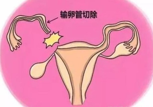 哺乳期要注意饮食健康，喝气泡水饮料会引起副作用