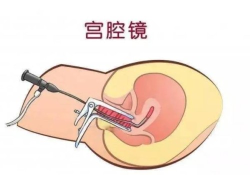 深圳三代试管助孕：如何确定试管移植成功后的孕周？有哪些方法可以进行计算？